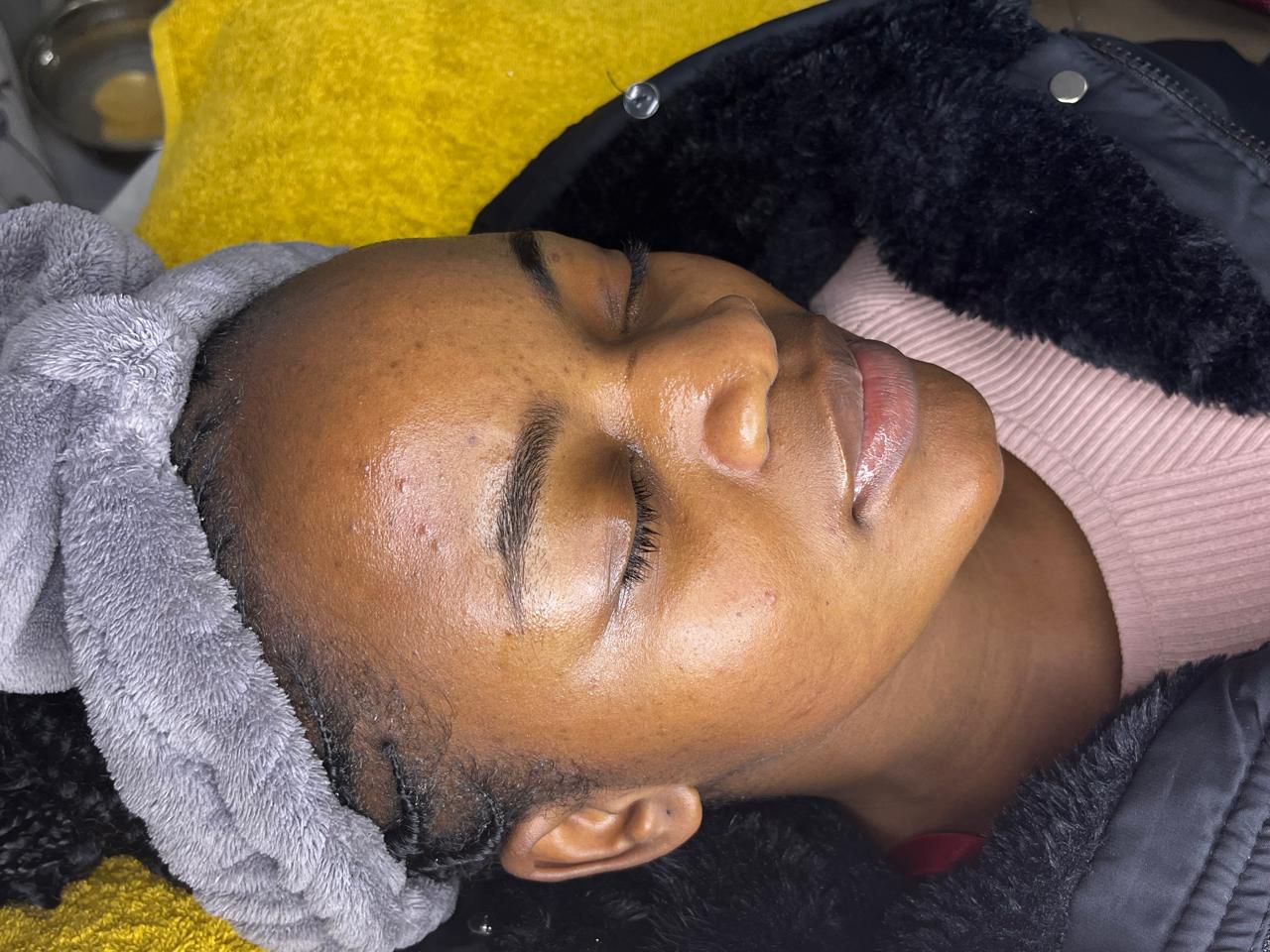 Luxury facial treatment at InfiDerm Aesthetics